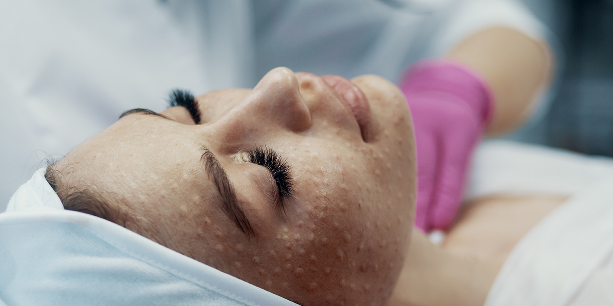5 tretmana za jesenju negu kože